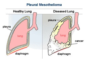 visceral pleura parietal pleura